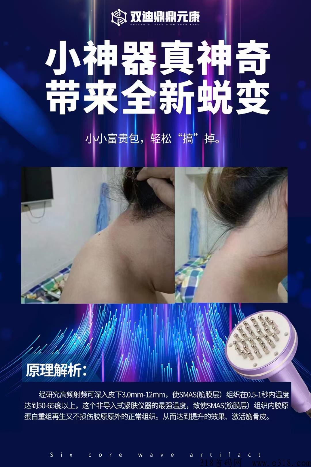 双迪六核波小神器，拿牌直销公司，家家必备，建立10年持续收益